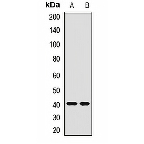 OTC Rabbit Polyclonal Antibody