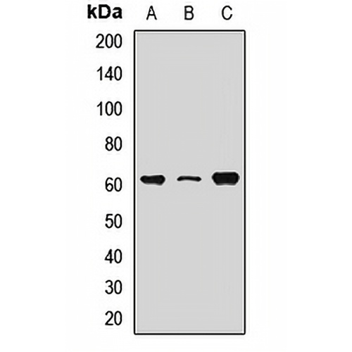 RPE65 Rabbit Polyclonal Antibody