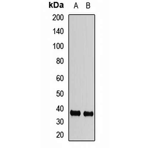 FBP2 Rabbit Polyclonal Antibody