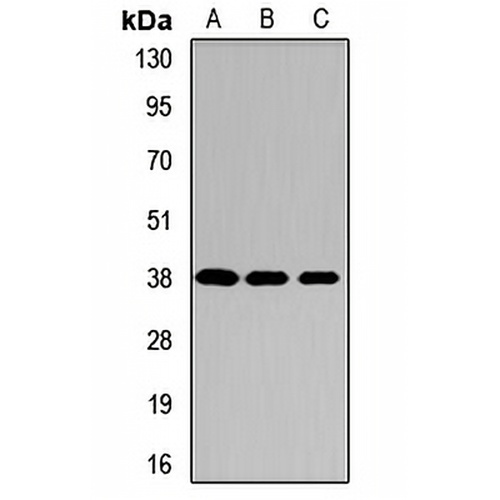 AIP Rabbit Polyclonal Antibody