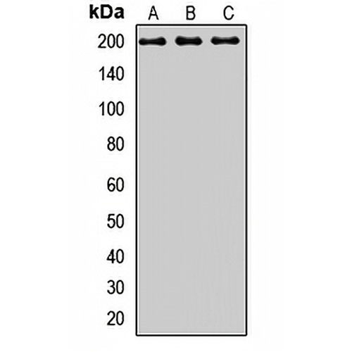 CD280 Rabbit Polyclonal Antibody