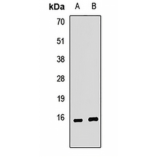 KCNE2 Rabbit Polyclonal Antibody