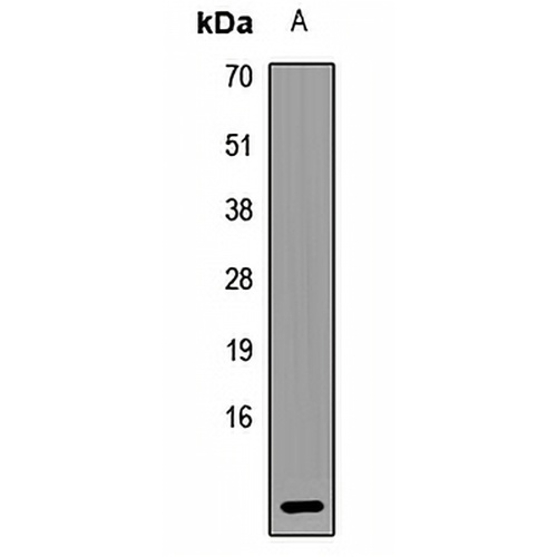 UQCRQ Rabbit Polyclonal Antibody
