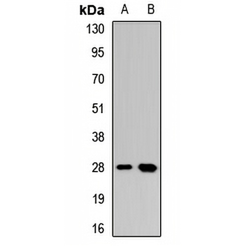 Dectin 1 Rabbit Polyclonal Antibody