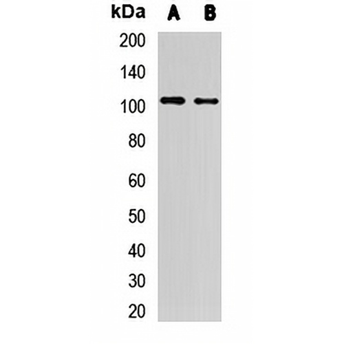 MetRS Rabbit Polyclonal Antibody