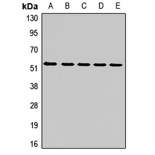 MT-ND4 Rabbit Polyclonal Antibody