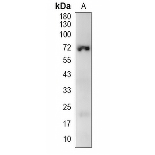 SOCS6 Rabbit Polyclonal Antibody