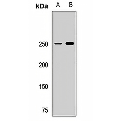 TRIP12 Rabbit Polyclonal Antibody
