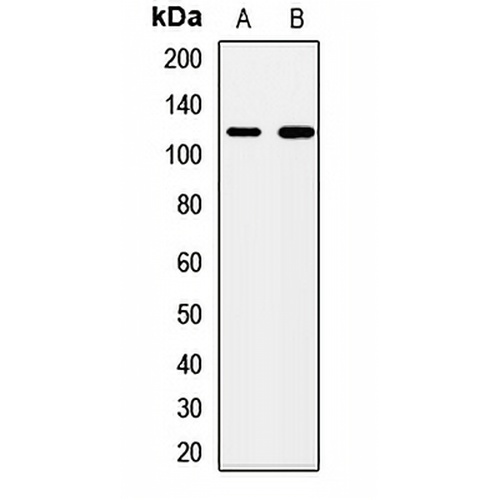 PMPCA Rabbit Polyclonal Antibody