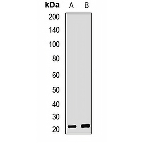 RPP25 Rabbit Polyclonal Antibody