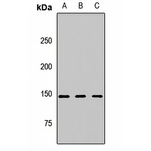 CSPP1 Rabbit Polyclonal Antibody