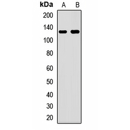 FTSJ3 Rabbit Polyclonal Antibody