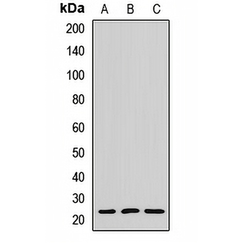 MYL6B Rabbit Polyclonal Antibody