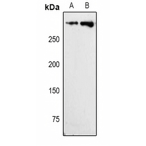 Ki67 Rabbit Polyclonal Antibody