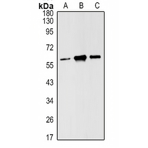 Estrogen Receptor beta Rabbit Polyclonal Antibody