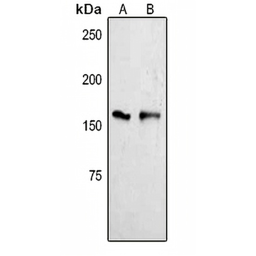 YTHDC2 Rabbit Polyclonal Antibody