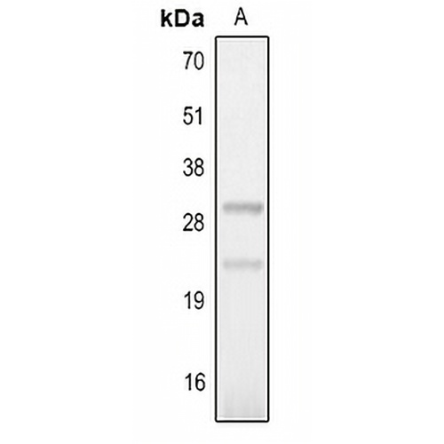 IL-25 Rabbit Polyclonal Antibody