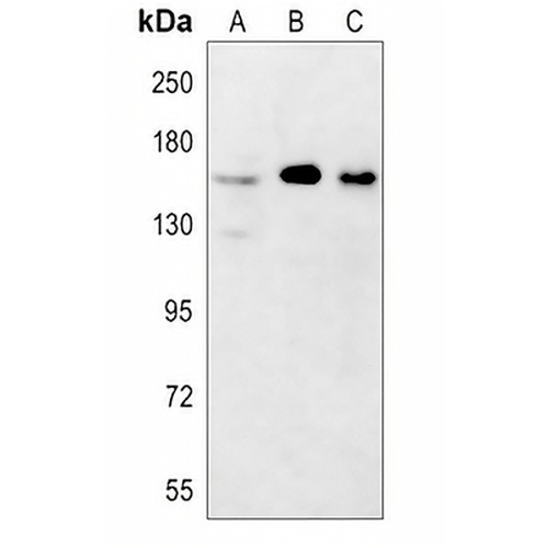 YTHDC2 Rabbit Polyclonal Antibody