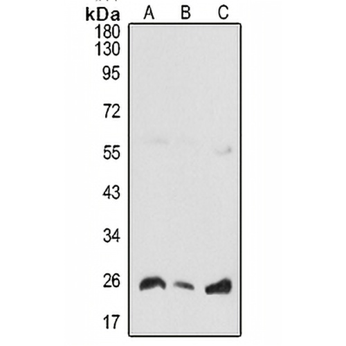 COMMD5 Rabbit Polyclonal Antibody