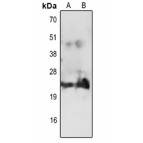 CD3e Rabbit Polyclonal Antibody