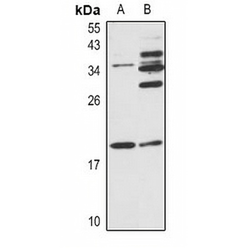 JDP2 Rabbit Polyclonal Antibody