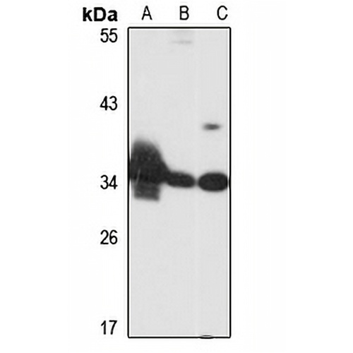 MARCH8 Rabbit Polyclonal Antibody