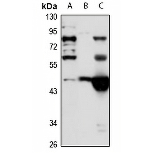 A4GALT Rabbit Polyclonal Antibody