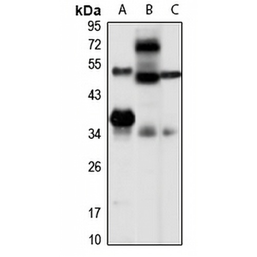 LYS5 Rabbit Polyclonal Antibody