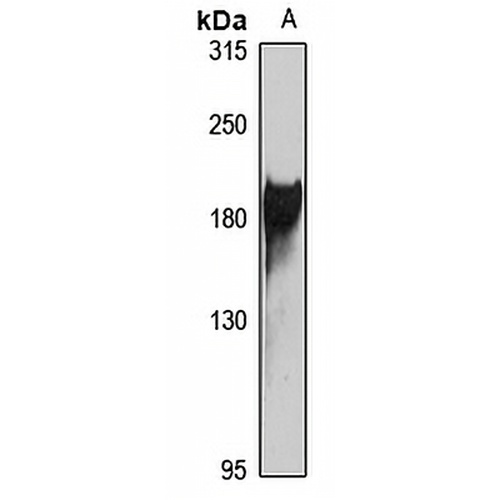 ABCA3 Rabbit Polyclonal Antibody