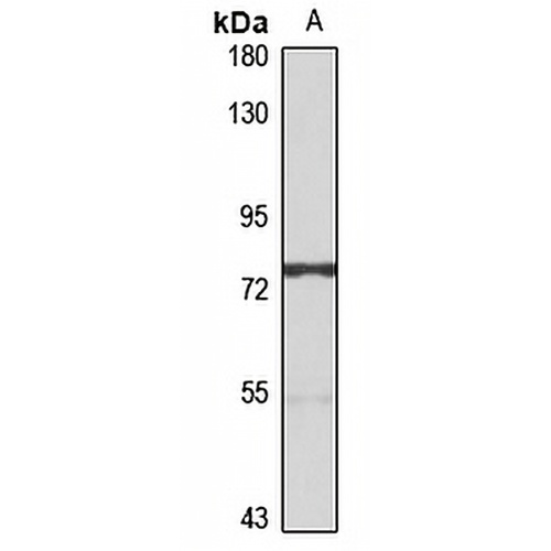 ABCG5 Rabbit Polyclonal Antibody