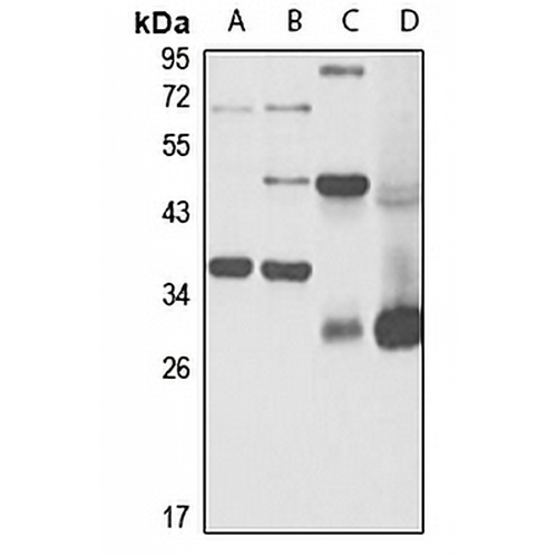 ABT1 Rabbit Polyclonal Antibody