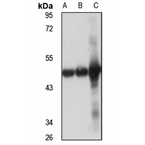 ACAA2 Rabbit Polyclonal Antibody