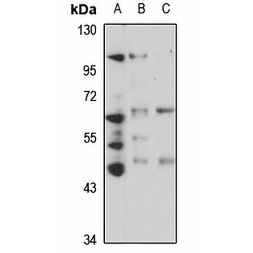ACD Rabbit Polyclonal Antibody