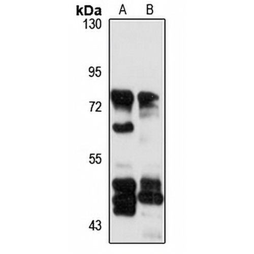 ACOX2 Rabbit Polyclonal Antibody