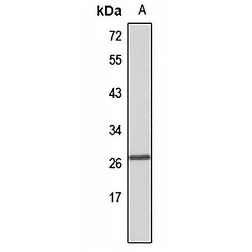 ACRV1 Rabbit Polyclonal Antibody
