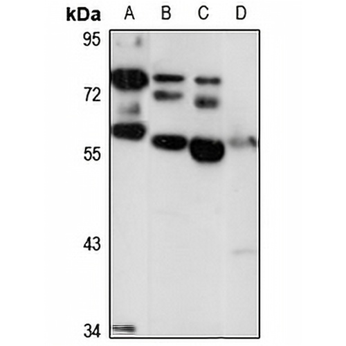 ACSF3 Rabbit Polyclonal Antibody