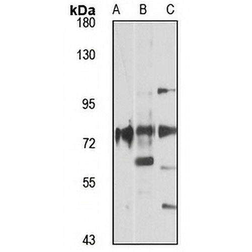 ACSL1 Rabbit Polyclonal Antibody