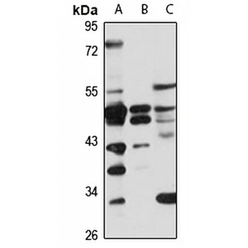 ACTL8 Rabbit Polyclonal Antibody