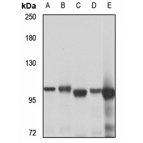 ACTL8 Rabbit Polyclonal Antibody