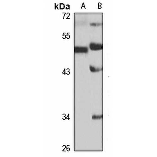 ACVR1 Rabbit Polyclonal Antibody