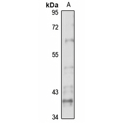 ACVR2B Rabbit Polyclonal Antibody