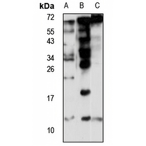 ACYP2 Rabbit Polyclonal Antibody