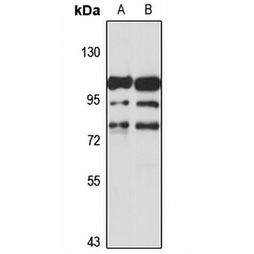 ADAM11 Rabbit Polyclonal Antibody