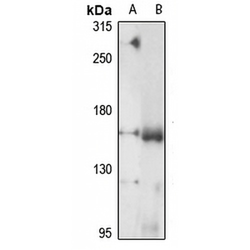 ADAMTS13 Rabbit Polyclonal Antibody