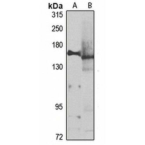Adenylate Cyclase 2 Rabbit Polyclonal Antibody