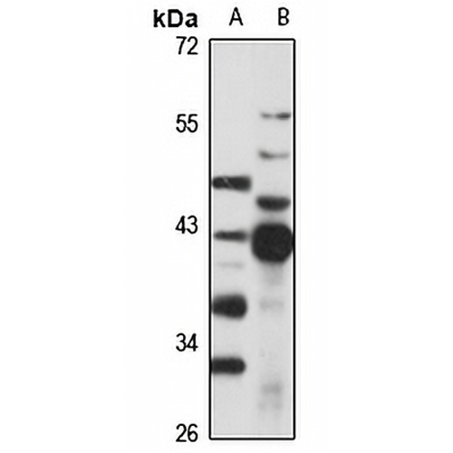 ADH1 Rabbit Polyclonal Antibody
