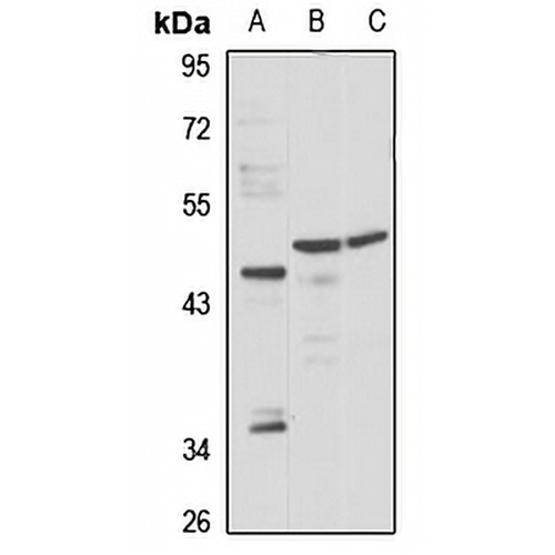 AdipoR2 Rabbit Polyclonal Antibody