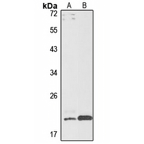 AGA Rabbit Polyclonal Antibody