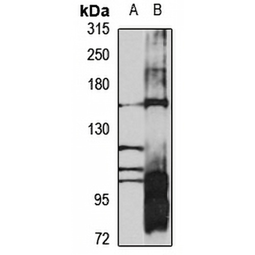 AGL Rabbit Polyclonal Antibody