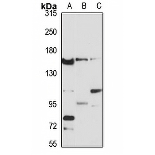 AGTPBP1 Rabbit Polyclonal Antibody